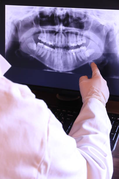 Best Emergency Treatment for Dental Infections or Abscesses in Ravensworth, VA