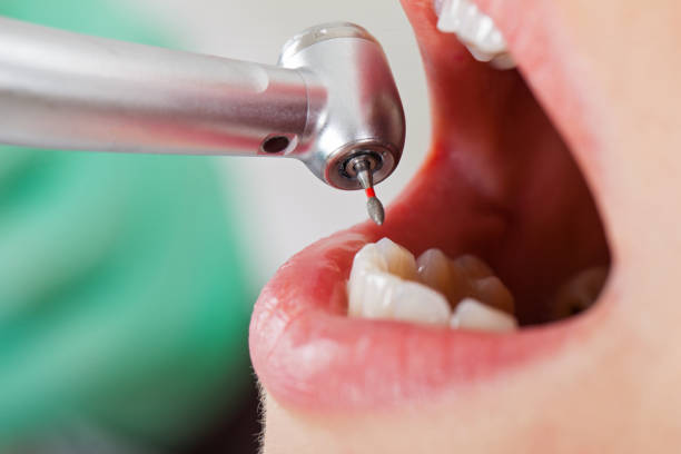 Best Same-Day Emergency Dental Services in Ravensworth, VA
